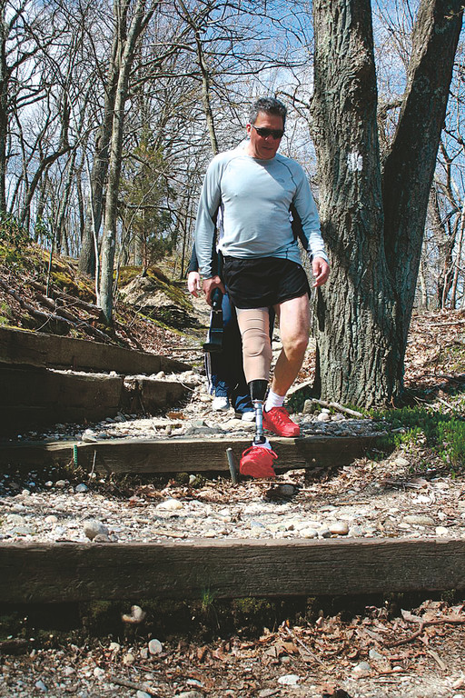 A new walking prosthetic will enhance Dr. Gur&rsquo;s quality of life.