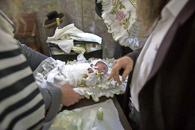 A brit milah performed by a mohel in the Mea She&rsquo;arim neighborhood in Jerusalem on Nov. 9, 2014.