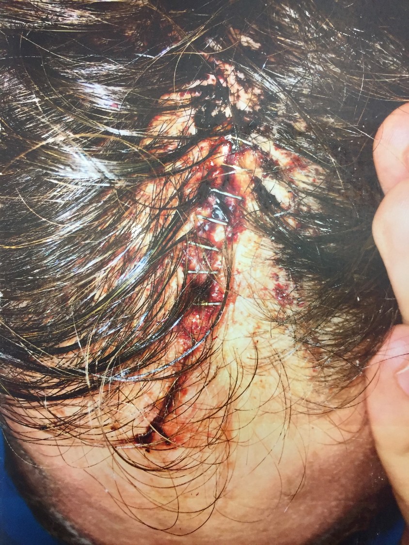 Also submitted as evidence, the photo shows Kavanagh's laceration, which the prosecution claims was suffered after Federico struck him on the head with a Taser.