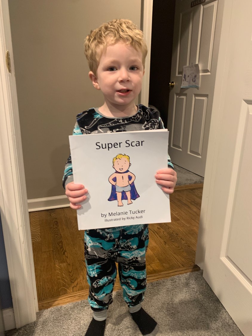 Asher Tucker was born with a congenital heart defect, Tetralogy of Fallot. His mother, Melanie Tucker, wrote the children’s book “Super Scar” to spread awareness of congenital heart disease.