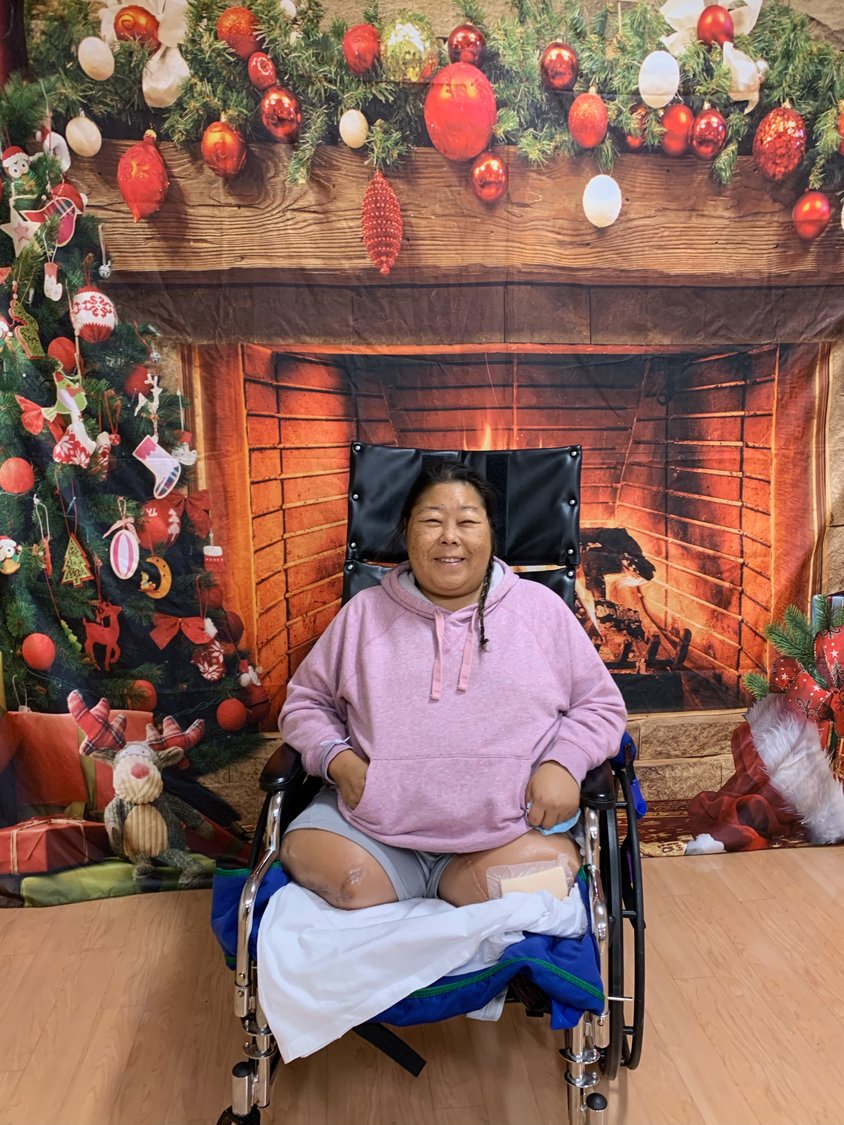 Freeport’s Risa Asami is determined to lead a fulfilling life despite having both legs amputated due to hereditary health challenges. She is currently staying at the Amputee Walking School in Roslyn, working toward getting prosthetics and being able to do the things she used to do.