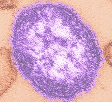 The measles virus can survive in the air for several hours and may be transmitted to unvaccinated individuals even after the infected person has left the room.