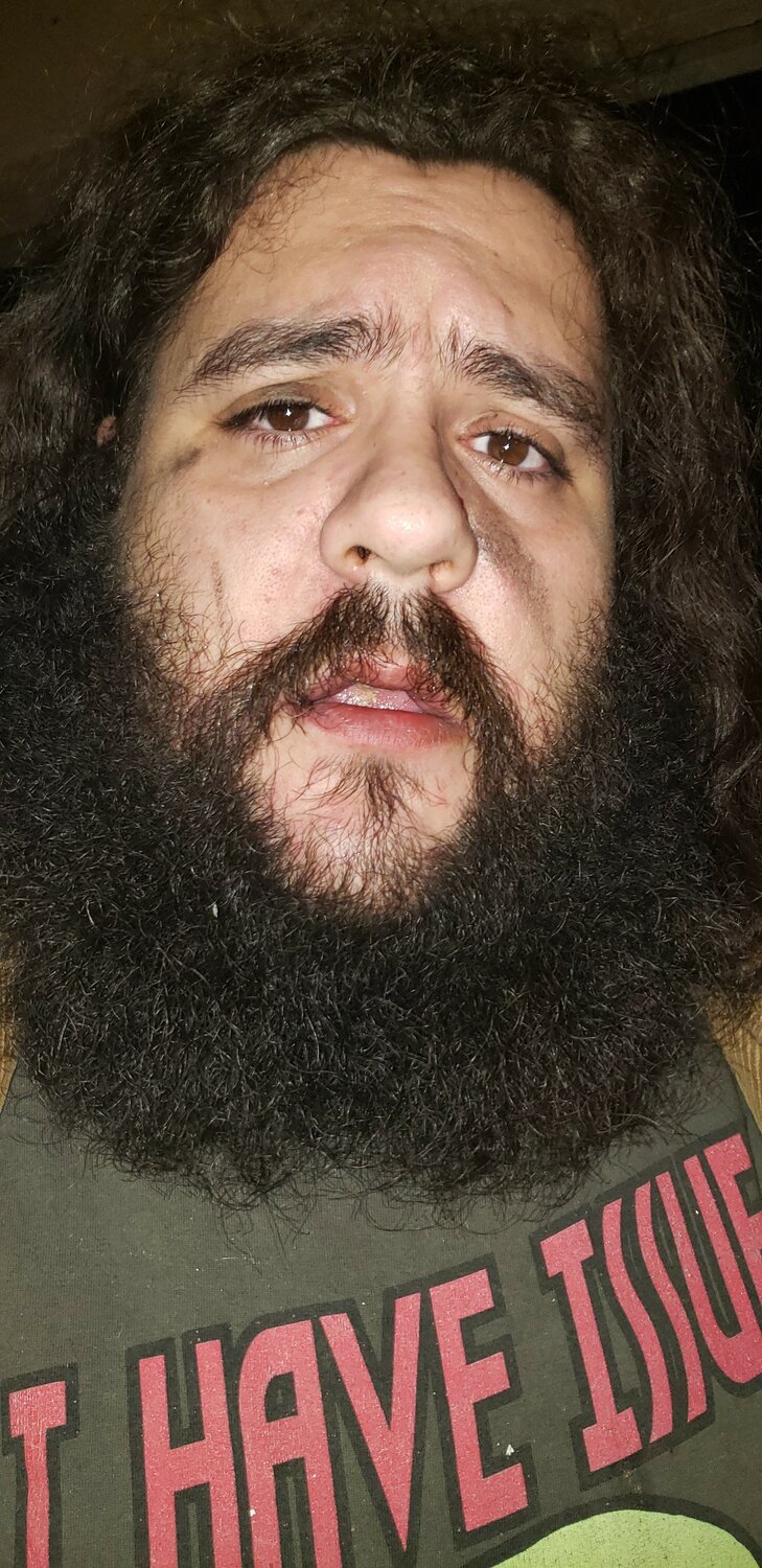 A photo Joshua Anderson shared of himself while in active addiction.